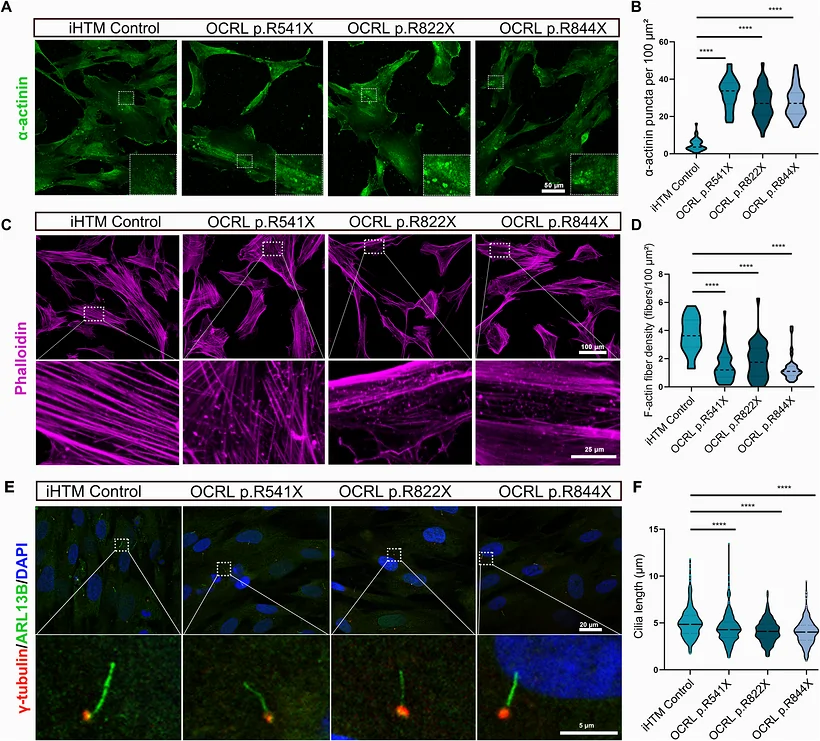 Panel E, "iHTM Control" column: gamma-tubulin (red, basal body), ARL13B (green, ciliary axoneme) and DAPI (blue) in human iPSC-derived trabecular meshwork cells, showing a normal primary cilium. Part of a composite figure on OCRL mutations in Lowe syndrome.