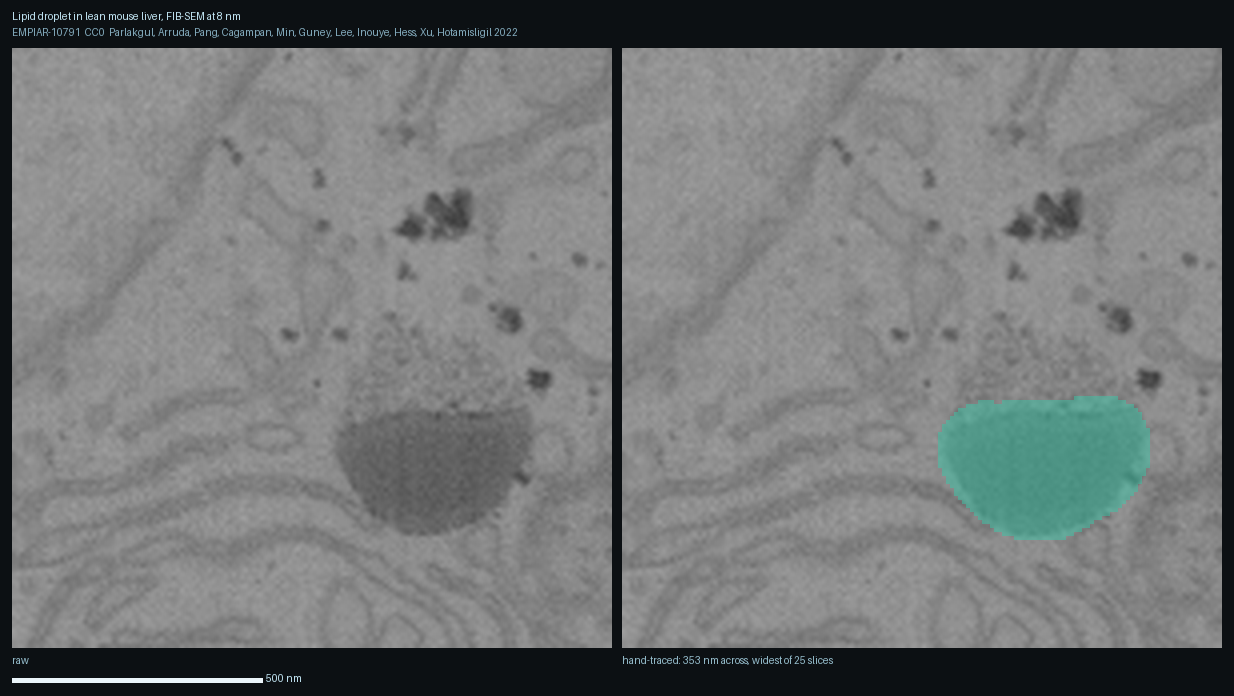 A lipid droplet in lean mouse liver, raw on the left and the depositors' own hand tracing on the right. The droplet is the smooth featureless body: neutral lipid has no internal structure to resolve, which is what distinguishes it from every membrane-bound organelle around it. The ER membranes crowding it are visible as the fine parallel lines. Measured from the tracing, this droplet is 353 nm across at the widest of its 25 slices.