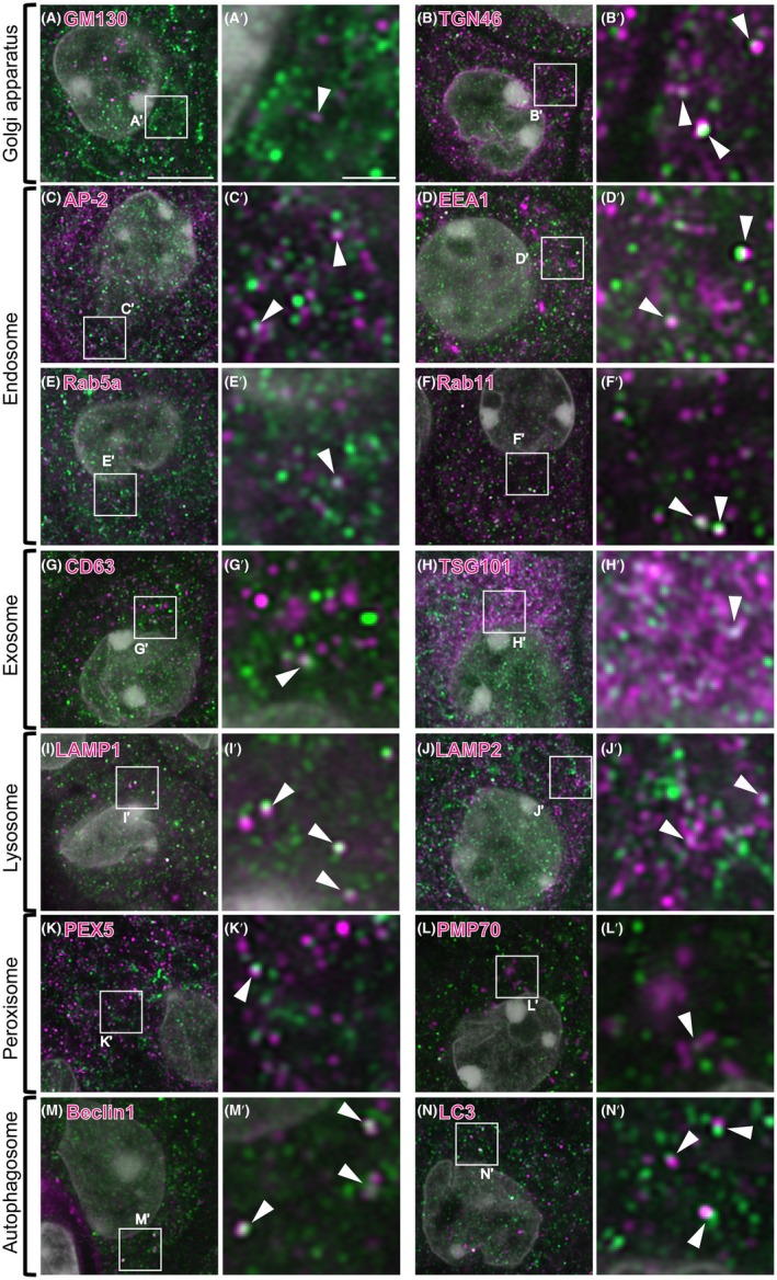 Panel D (EEA1): early endosome marker as magenta puncta, inset with arrowheads. composite of 14 immunofluorescence panels, mouse choroid plexus epithelial cells; magenta channel is the named organelle marker