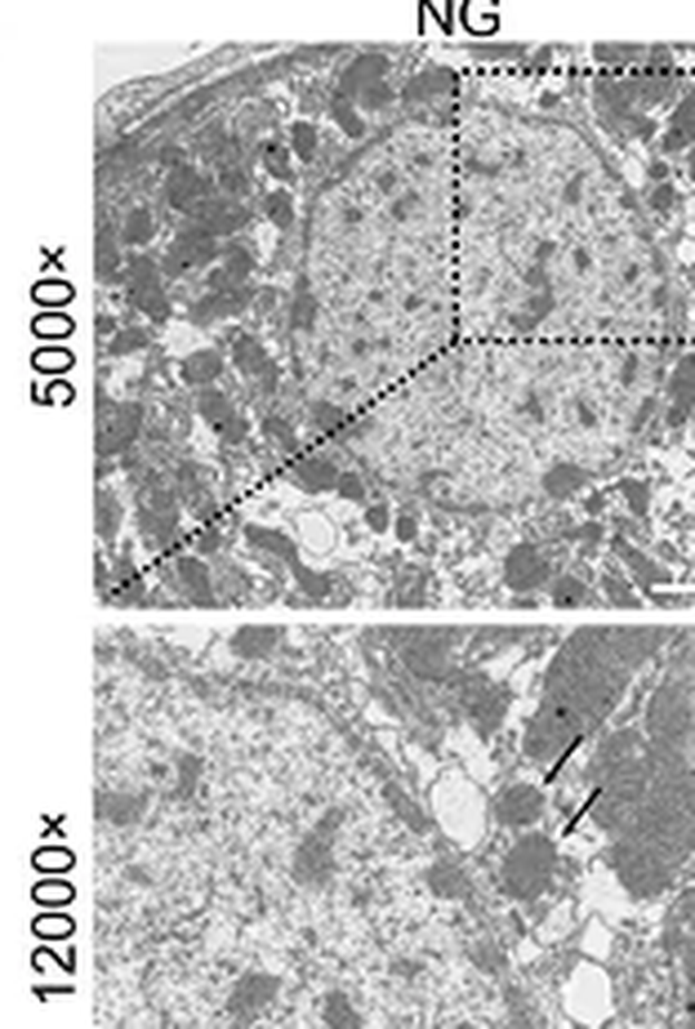 The authors' caption for the figure reads: "Representative TEM images showing peroxisomal morphology and number in HK-2 cells under the indicated conditions. Scale bars, 2 um (5000x), 500 nm (12000x)." This is the NG column, normal glucose with no treatment, which is the untreated control of a three-condition comparison; the other two columns are vehicle and USP30 overexpression and are not shown here. Human proximal tubule cells. The arrows in the lower row are the authors' marks on peroxisomes.