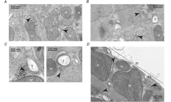 The authors' caption for the figure reads: "Ribosomes colocalize with the SR Representative electron micrographs of adult rat ventricular myocytes show (A) ribosome (arrowheads) association with perinuclear membranes (ER), (B) peripheral membranes (longitudinal, free SR), (C) T‐tubules (near junctional SR) and (D) in the subsarcolemmal region, specifically at the terminal sarcolemma (TS) of intercalated disc (ID). M, mitochondria; T, T‐tubules; N, nucleus." Cropped to panels A to D, the electron micrographs; panels E and F, mouse immunofluorescence, are not shown.