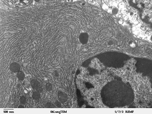 Transmission electron microscope image of a thin section cut through an area of mammalian lung tissue. This image of a bronchiolar exocrine cell (Club cell) shows a nucleus and cytoplasmic organelles, such as rough endoplasmic reticulum and mitochondria.
