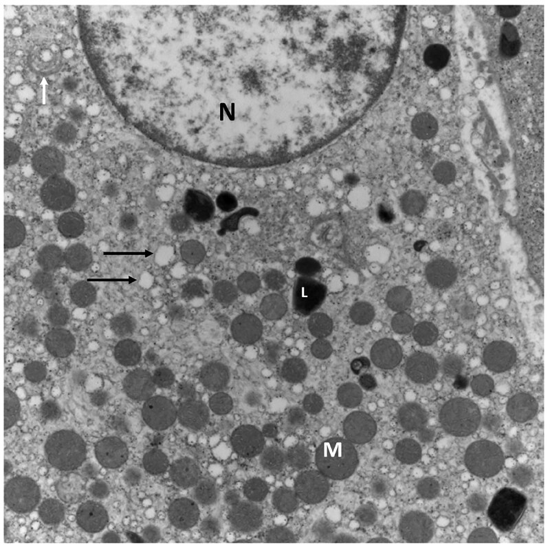 High-magnification electron micrograph of a Leydig cell from an adult white crossbred boar (×18,600). A portion of the nucleus (N) is visible, along with abundant spherical mitochondria (M) and extensive, vesiculated smooth endoplasmic reticulum (black arrow), characteristic of steroidogenic cells. Lysosomes (L) and a Golgi apparatus (white arrow) are also visible.
